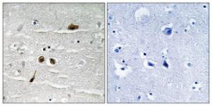 Immunohistochemical analysis of paraffin-embedded human brain using Anti-MDC1 (phospho Ser513) Antibody. The right hand panel represents a negative control, where the antibody was pre-incubated with the immunising peptide.