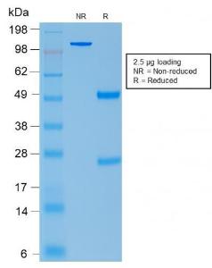 SDS-PAGE analysis of Anti-ACTH Antibody [CLIP/2040R] under non-reduced and reduced conditions; showing intact IgG and intact heavy and light chains, respectively. SDS-PAGE analysis confirms the integrity and purity of the antibody