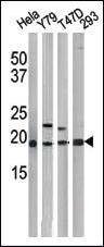 Anti-CDKN1A Rabbit Polyclonal Antibody