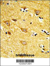 Anti-Inositol Polyphosphate 4-phosphatase Type II Rabbit Polyclonal Antibody (AP (Alkaline Phosphatase))