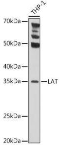 Western blot analysis of extracts of THP-1 cells, using Anti-LAT Antibody (A9734) at 1:1,000 dilution