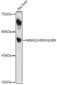 Western blot analysis of extracts of Rat liver, using Anti-HB9 / HLXB9 / MNX1 Antibody (A306300) at 1:1000 dilution