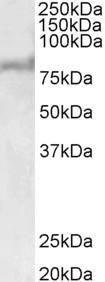 Anti-ABCD2 Antibody (A83712) (1 µg/ml) staining of Human Liver lysate (35 µg protein in RIPA buffer) Primary incubation was 1 hour Detected by chemiluminescence