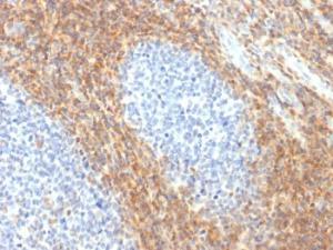 Immunohistochemical analysis of formalin-fixed, paraffin-embedded human tonsil using Anti-CD52 Antibody [CD52/2276R]