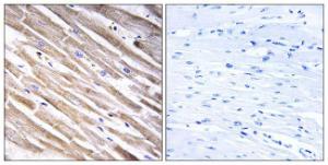 Immunohistochemical analysis of paraffin-embedded human heart tissue using Anti-RPL3L Antibody. The right hand panel represents a negative control, where the antibody was pre-incubated with the immunising peptide.