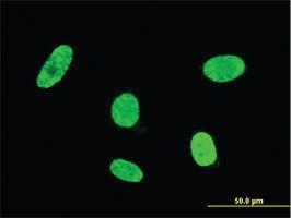 Anti-GSC Mouse Monoclonal Antibody [clone: 4B9]