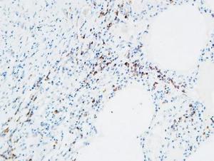 Immunohistochemical analysis of paraffin-embedded human lung using Anti-MPO Antibody