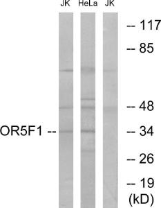 Western blot analysis of lysates from HeLa and Jurkat cells using Anti-OR5F1 Antibody. The right hand lane represents a negative control, where the antibody is blocked by the immunising peptide.