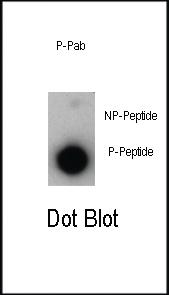 Anti-TRB Rabbit Polyclonal Antibody