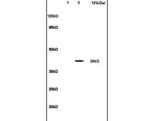 Anti-LTB4R Rabbit Polyclonal Antibody