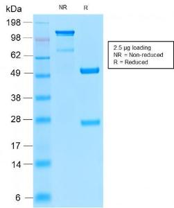 Immunohistochemical analysis of formalin-fixed, paraffin-embedded human tonsil using Anti-CD52 Antibody [CD52/2276R]