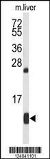 Anti-HBA2 Rabbit Polyclonal Antibody (HRP (Horseradish Peroxidase))