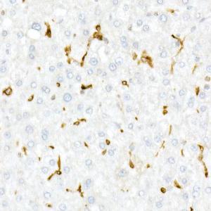 Immunohistochemistry analysis of paraffin-embedded human liver using Anti-CD74 Antibody (A9737) at a dilution of 1:20 (40x lens) Perform high pressure antigen retrieval with 10 mM Tris/EDTA buffer pH 90 before commencing with IHC staining protocol