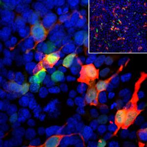 Anti-GFP antibody