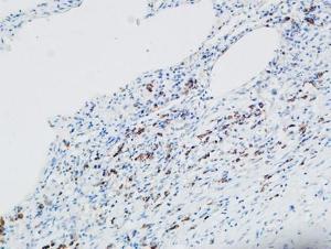 Immunohistochemical analysis of paraffin-embedded human lung using Anti-MPO Antibody