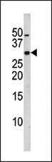 Anti-CDKN1B Rabbit Polyclonal Antibody