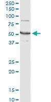 Anti-GLUD2 Mouse Monoclonal Antibody [clone: 3C2]