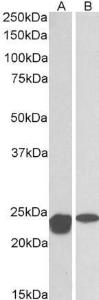 Anti-SOD2 Antibody (A83715) (0.01 µg/ml) staining of Mouse (A) and Rat (B) Spinal Cord lysates (35 µg protein in RIPA buffer). Primary incubation was 1 hour. Detected by chemiluminescence