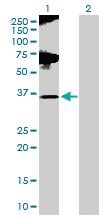 Anti-GLUL Rabbit Polyclonal Antibody