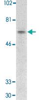 Anti-IRAK2 Rabbit Polyclonal Antibody