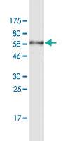 Anti-NR1H3 Mouse Monoclonal Antibody [clone: 3E9]