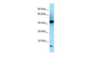 Anti-RGP1 Rabbit Polyclonal Antibody