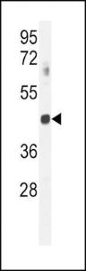 Anti-GNAT2 Rabbit Polyclonal Antibody (FITC (Fluorescein Isothiocyanate))