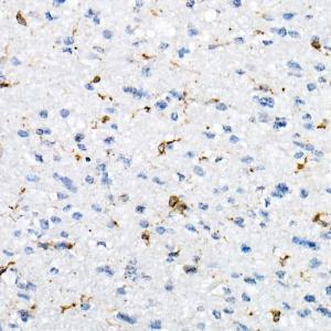 Immunohistochemistry analysis of paraffin-embedded human brain tissue using Anti-CD74 Antibody (A9737) at a dilution of 1:20 (40x lens) Perform high pressure antigen retrieval with 10 mM Tris/EDTA buffer pH 90 before commencing with IHC staining protocol