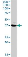 Anti-GLUL Rabbit Polyclonal Antibody