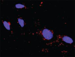 Anti-STK36 + GLI3 Antibody Pair