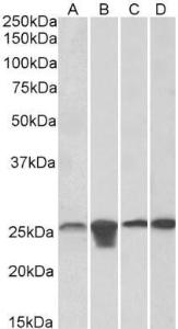 Anti-SOD2 Antibody (A83715) (0.1 µg/ml) staining of HeLa, HepG2, HEK293 and NIH3T3 (35 µg protein in RIPA buffer). Primary incubation was 1 hour. Detected by chemiluminescence