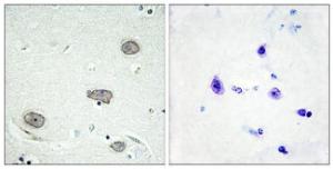 Antibody anti-CSFR phospho TYR809 100 µg