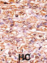 Anti-CDKN1B Rabbit Polyclonal Antibody