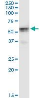 Anti-HKDC1 Mouse Monoclonal Antibody