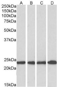 Anti-SOD2 Antibody (A83715) (0.3 µg/ml) staining of Human Cerebellum (A), Mouse Brain (B), Rat Brain (C) and Pig Brain (D) lysates (35 µg protein in RIPA buffer). Primary incubation was 1 hour. Detected by chemiluminescence