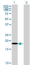 Anti-XG (Xg blood group) Mouse Polyclonal Antibody