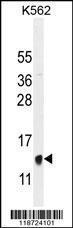 Anti-HBB Rabbit Polyclonal Antibody (Biotin)