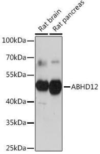 Western blot analysis of extracts of various cell lines, using Anti-ABHD12 Antibody (A309202) at 1:1,000 dilution