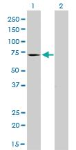 Anti-MTM1 Mouse Monoclonal Antibody [clone: 1C10]