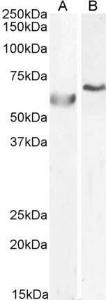 Anti-POLL Antibody (A83716) (0.5 µg/ml) staining of A549 (A) and (1ug/ul) HepG2 (B) cell lysate (35 µg protein in RIPA buffer). Primary incubation was 1 hour. Detected by chemiluminescence