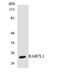 Western blot analysis of the lysates from HepG2 cells using Anti-RAB7L1 Antibody