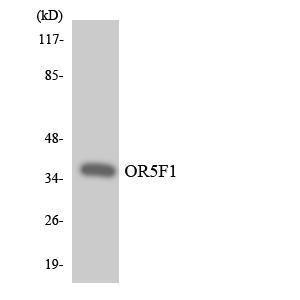 Western blot analysis of the lysates from COLO205 cells using Anti-OR5F1 Antibody