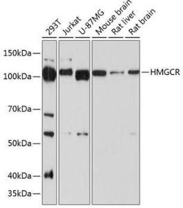 Western blot analysis of extracts of various cell lines, using Anti-HMGCR Antibody [ARC0496] (A306303) at 1:1000 dilution. The secondary Antibody was Goat Anti-Rabbit IgG H&L Antibody (HRP) at 1:10000 dilution. Lysates/proteins were present at 25 µg per lane