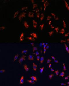 Immunofluorescence analysis of C6 cells using Anti-CD74 Antibody (A9737) at a dilution of 1:100 DAPI was used to stain the cell nuclei (blue)