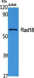 Western blot analysis of various cells using Anti-RAD18 Antibody