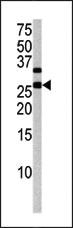 Anti-CDKN1B Rabbit Polyclonal Antibody