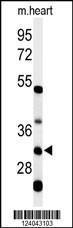 Anti-HCCS Rabbit Polyclonal Antibody