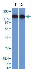 Anti-CD22 Mouse Monoclonal Antibody [clone: BLCAM/1795]