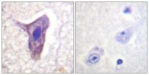 Immunohistochemical analysis of paraffin-embedded human brain using Anti-CD88 (phospho Ser338) Antibody The right hand panel represents a negative control, where the antibody was pre-incubated with the immunising peptide