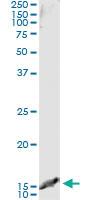 Anti-TCL1A Antibody Pair